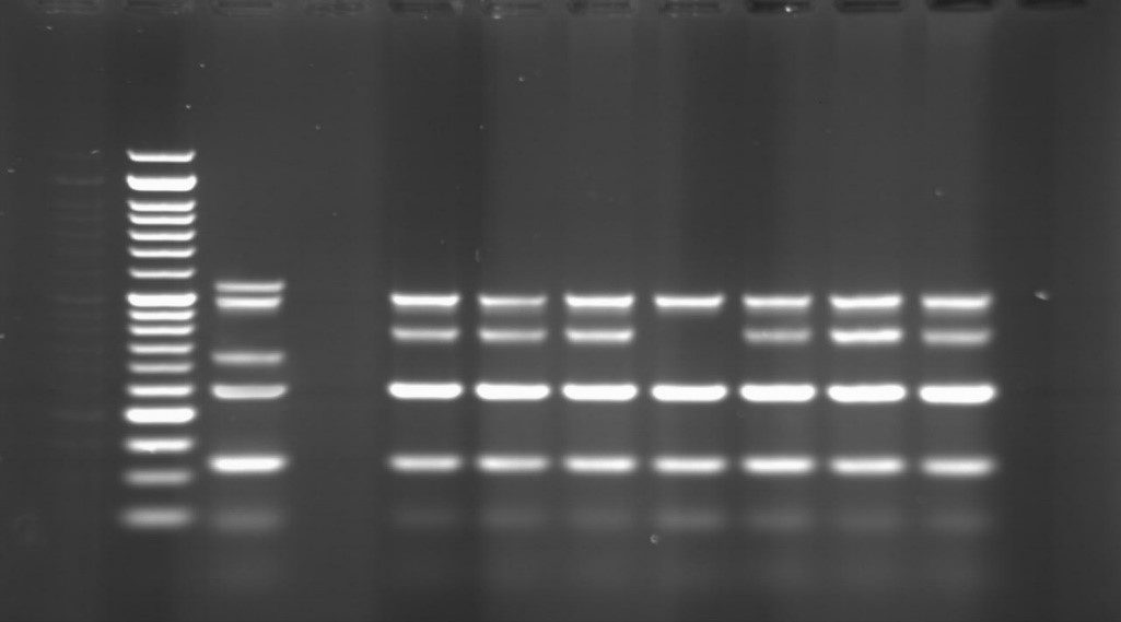شکل 3: نتایجPCR Multiplex- جهت شناسایی ژنهای ژنهای OPR-L با طول باند bp 504، OPR-I با طول باند bp 249، ALG-D با طول باند bp 520، EXO-S با طول باند bp 118 و EXT-A با طول باند bp 396، در نمونه¬های انسانی، - شماره گوده¬ها به ترتیب از چپ به راست: چاهک اول نشانگر 50 bp، چاهک دوم کنترل مثبت، چاهک سوم کنترل منفی، چاهک چهارم تا دهم نمونه¬های انسانی واجد ژنهای مختلف