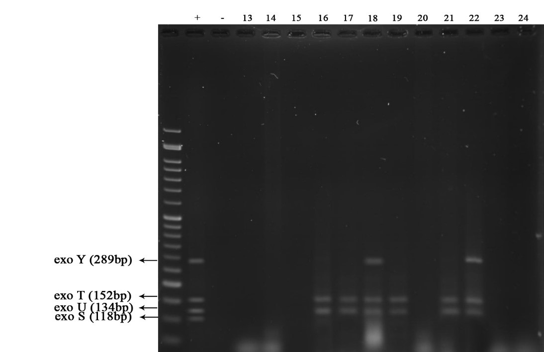 شکل 2: نتایجPCR Multiplex- جهت شناسایی ژنهای اگزوآنزیم‌های Y با طول باند bp 289، U با طول باند bp 134، T با طول باند bp 152 و S با طول باند bp 118، در نمونه¬های دامی - شماره گوده¬ها به ترتیب از چپ به راست: چاهک اول نشانگر 50 bp، چاهک دوم کنترل مثبت، چاهک سوم کنترل منفی، چاهک 13 تا 24 نمونه¬های دامی واجد ژنهای مختلف