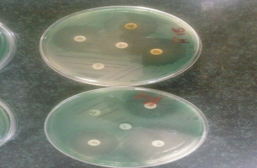 شکل 5: نمونه ای از نتایج تست آنتی بیوگرام به روش دیسک دیفیوژن بر روی محیط مولر هینتون آگار پس از انکوباسیون