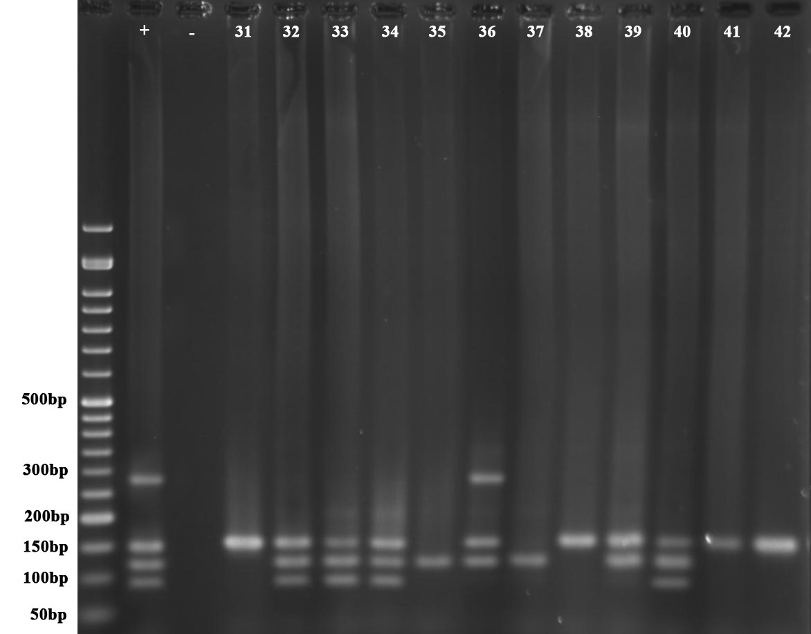 شکل 1: نتایجPCR Multiplex- جهت شناسایی ژنهای اگزوآنزیم‌های Y با طول باند bp 289، U با طول باند bp 134، T با طول باند bp 152 و S با طول باند bp 118، در نمونه¬های انسانی - شماره گوده¬ها به ترتیب از چپ به راست: چاهک اول نشانگر 50 bp، چاهک دوم کنترل مثبت، چاهک سوم کنترل منفی، چاهک 31 تا 42 نمونه¬های انسانی واجد ژنهای مختلف